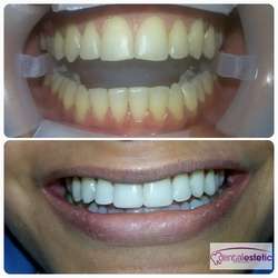 imagen de Tratamientos Dentales _1
