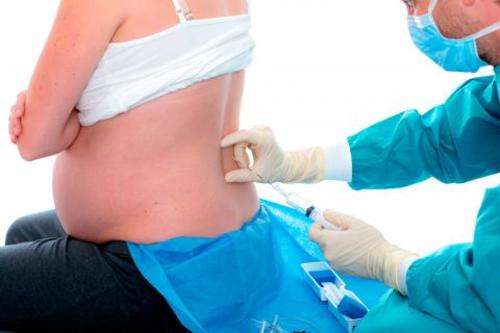 imagen de Anestesia Epidural en el Parto_1