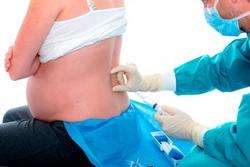 imagen de Anestesia Epidural en el Parto_1