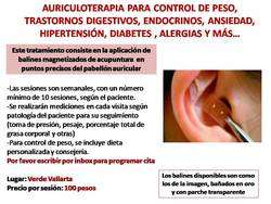 imagen de Auriculoterapia para el control de peso y mas_1