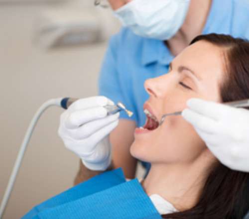 imagen de Limpieza bucal_1