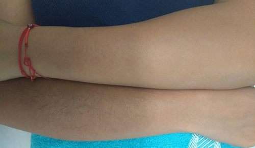 imagen de Depilacion de Brazos completos y axila_1