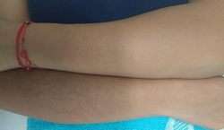 imagen de Depilacion de Brazos completos y axila_1