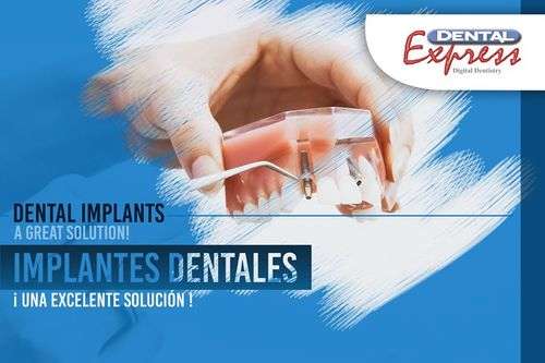 imagen de Dental Implants_1