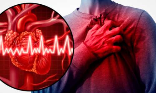 imagen de Paquete Cardiovascular_1