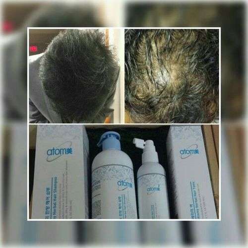 imagen de Shampoo ATOMY_1