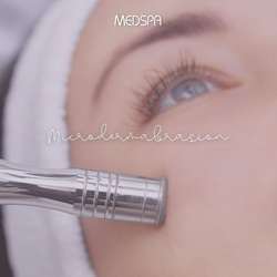 imagen de microdermabrasion _1