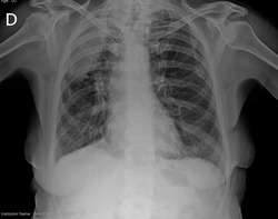 imagen de Radiografías_1