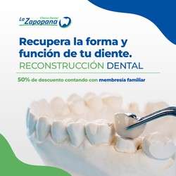 imagen de Recupera la forma y función de tu diente_1