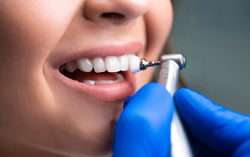 imagen de Limpieza dental _1
