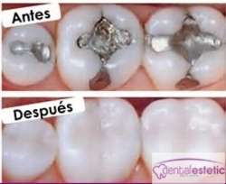 imagen de Tratamientos Dentales _2
