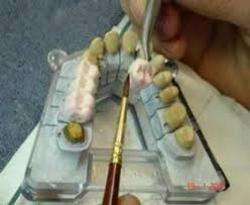 imagen de CERAMISTA DENTAL_2