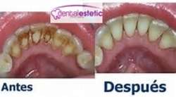 imagen de Tratamientos Dentales _3